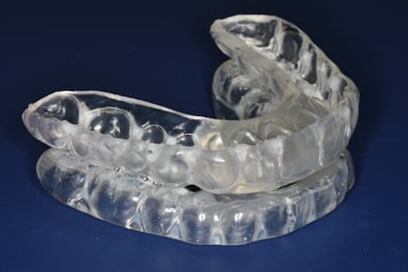 mouthguard to treat tmj